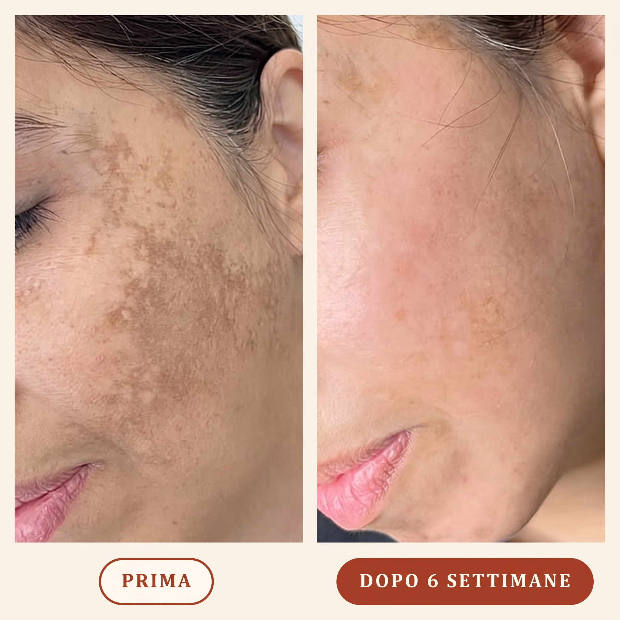 Sapone anti-macchie alla Curcuma™